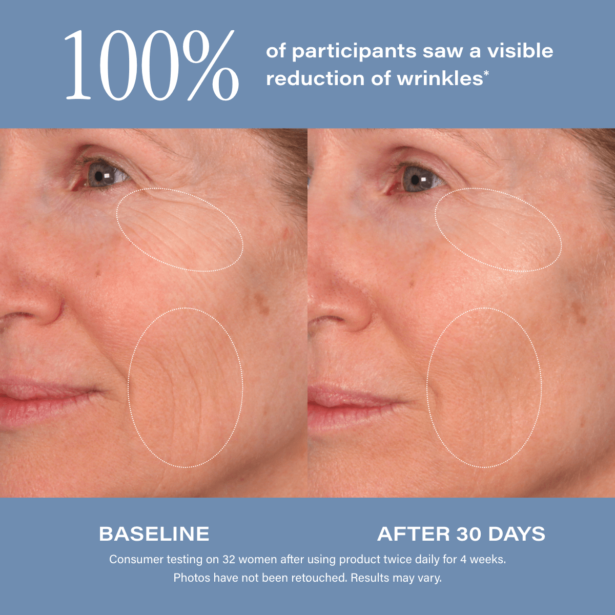 SKINN Age Reset Serum Intensive