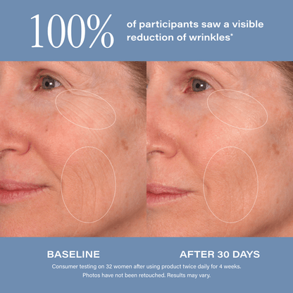 SKINN Age Reset Serum Intensive