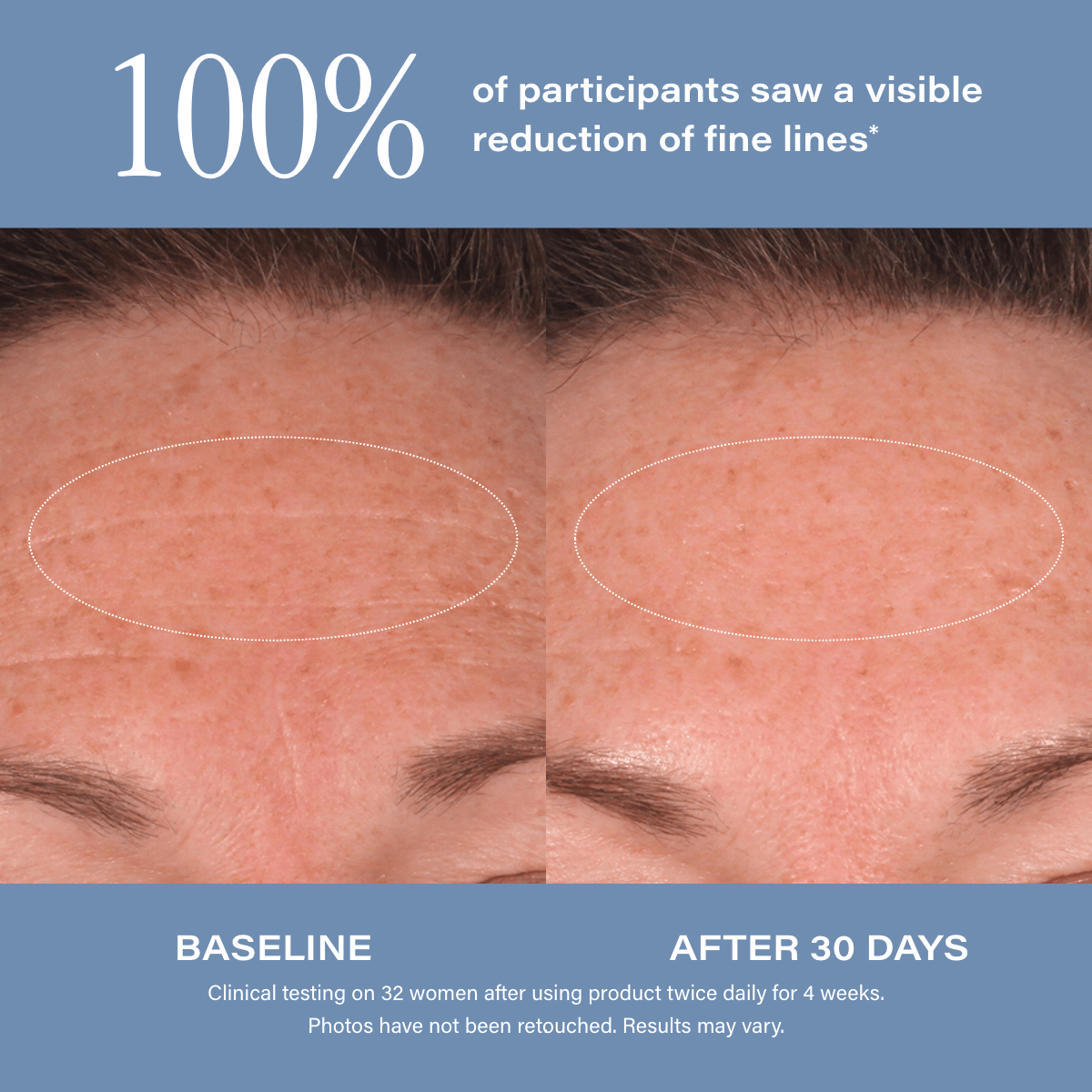 SKINN Age Reset Serum Intensive