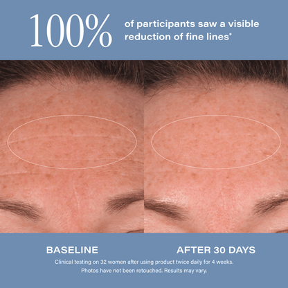 SKINN Age Reset Serum Intensive